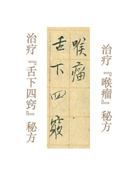 李咏抗癌与中医古籍
